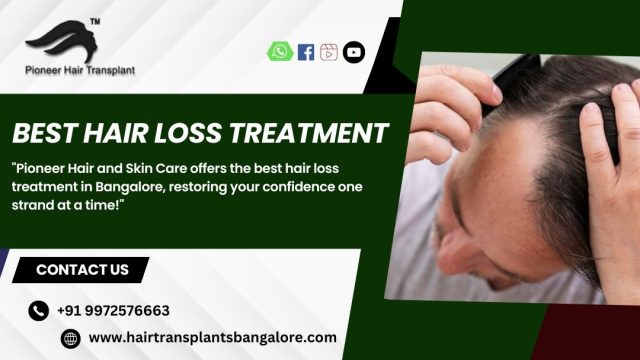 Best-Hair-Loss-Treatment-in-Bangalore-1